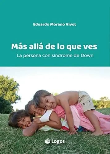 Más Allá De Lo Que Ves La Persona Con Síndrome De Down