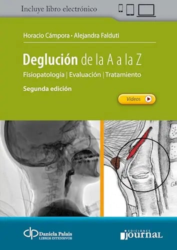 Deglucion De La A A La Z Disfagia