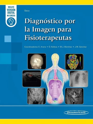 Diagnóstico Por La Imagen Para Fisioterapeutas 6/2024