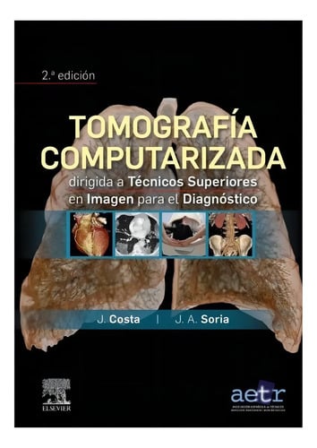 Tomografía Computarizada Técnicos  Imagen  Diagnóstico