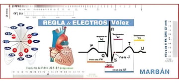Regla De Electros Vélez - Manual Interpretación Ecg