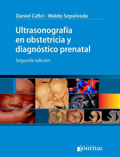 Ultrasonografía En Obstetricia Y Diagnóstico Prenatal