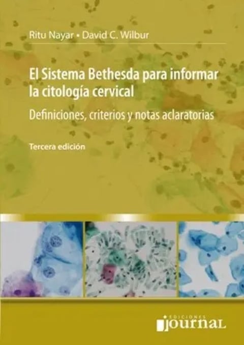 El Sistema Bethesda Citología Cervical Por David Wilbur