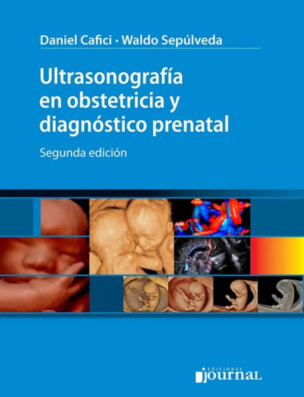 Ultrasonografía Obstetricia Diagnóstico Prenatal Ecografía