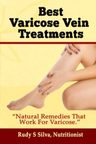 Varices Best Varicose Vein Treatments: Natural Remedies — imagen 1