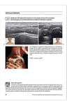 Atlas De Ecografía Para Patologías Musculoesqueléticas Comun — imagen 3