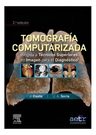 Tomografía Computarizada Técnicos Imagen Diagnóstico — imagen 4