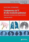 Fundamentos De Tc De Alta Resolucion Pulmonar - Webb — imagen 2