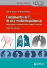 Fundamentos De Tc De Alta Resolucion Pulmonar - Webb — imagen 5