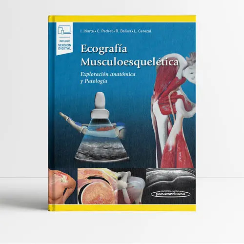 Ecografía Musculoesquelética Iriarte Medicina — imagen 2
