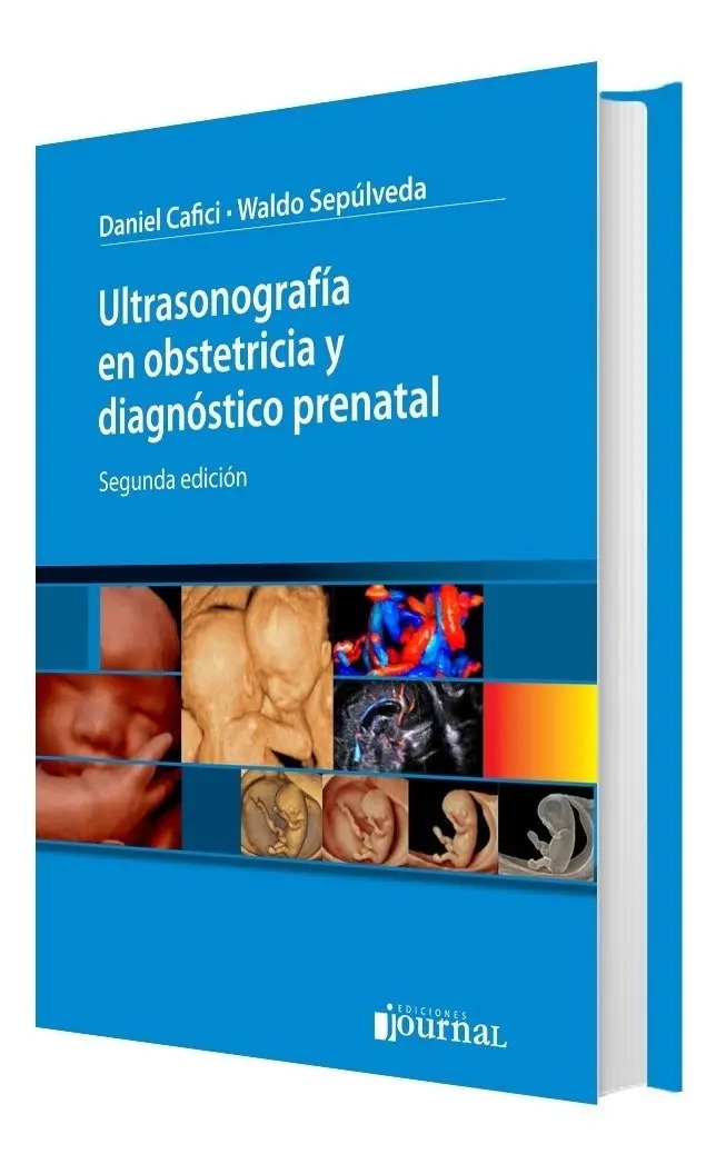 Ultrasonografía Obstetricia Diagnóstico Prenatal Ecografía — imagen 2